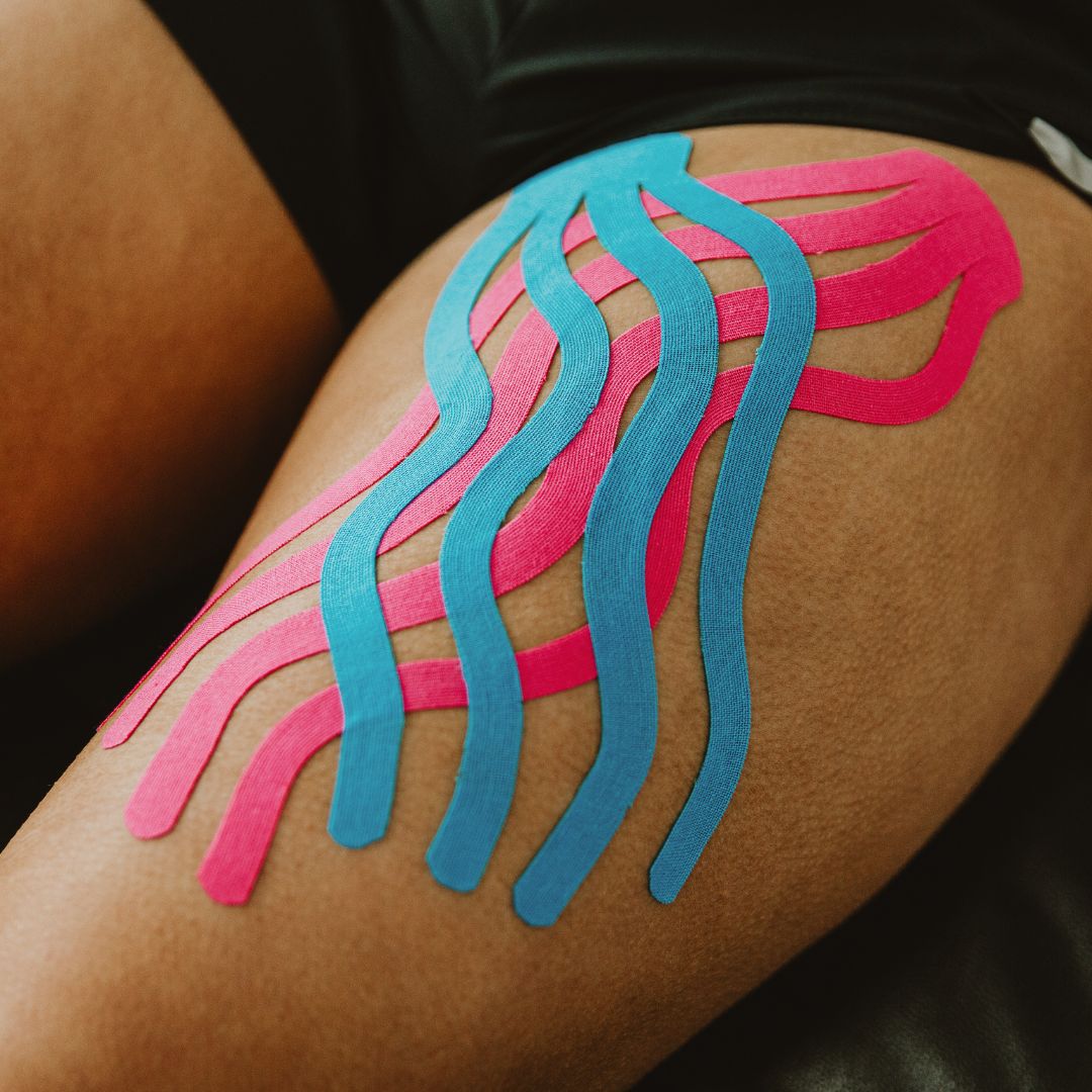 Bruising Application