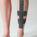 Shin Splints